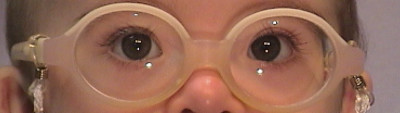 Niño con Síndrome de Down con gafas
