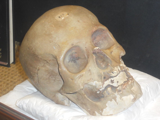 Cranial Deformation Mexican Skull A board was used as the primary means 