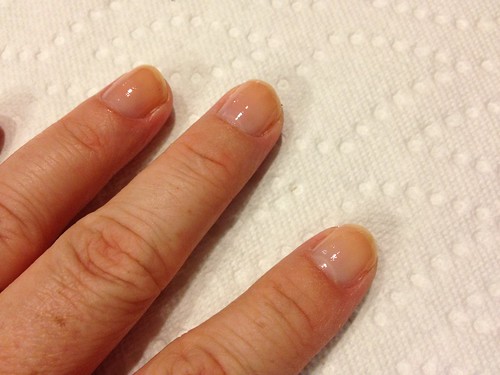 A nice base coat keeps your nails healthy and not so yellow-y.