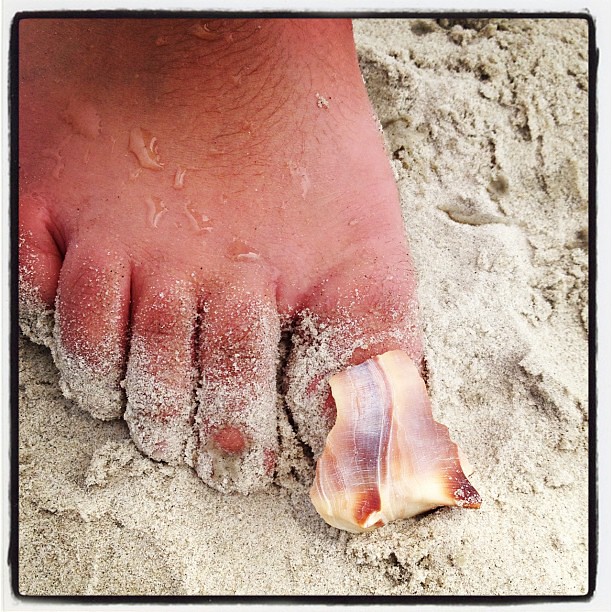 Blake's gross toenail
