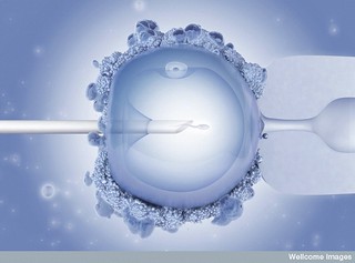 Photo:Intracytoplasmic Sperm Injection By:Image Editor
