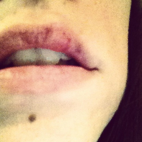 Busted M' Lip 33.365