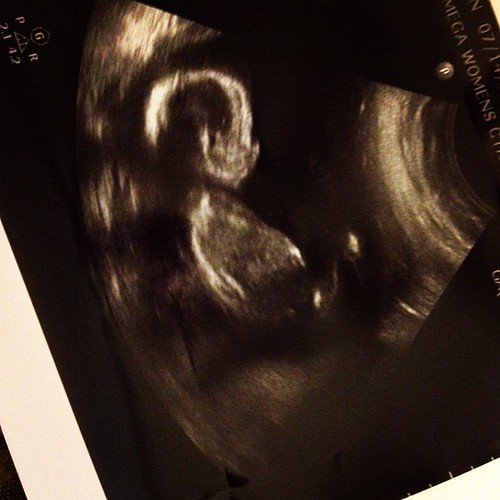 My favorite ultrasound pic of our little boy!