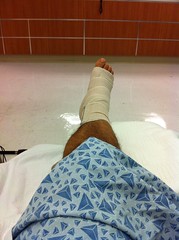 ankle surgery 1
