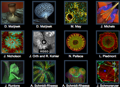 Micrografía. Menciones de Honor Olympus BioScapes 2011. 
