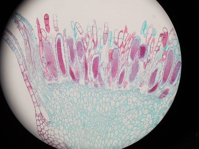 Moss Antheridial Head