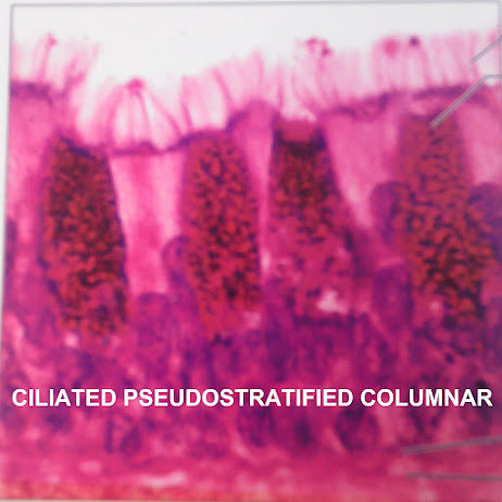 Pseudostratified+columnar