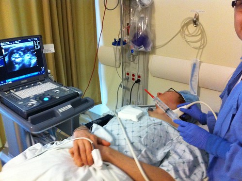 nerve finding ultrasound