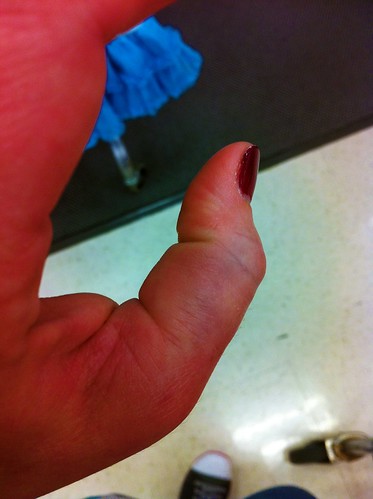 broken thumb