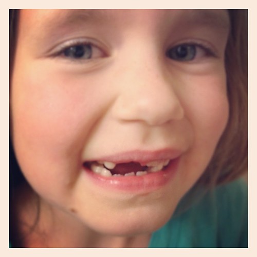 Hazel lost another tooth! Looks like she can fit two or three straws in there now.