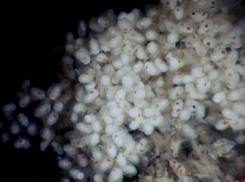 圖05、長出眼點，已具雛形的扁船蛸胚胎，長度不及0.1公分。（圖片拍攝：李坤瑄）