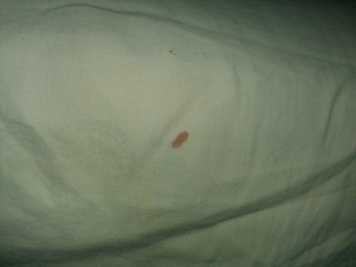 ... sheets? (ID needed, photos included) Â« Got Bed Bugs? Bedbugger Forums