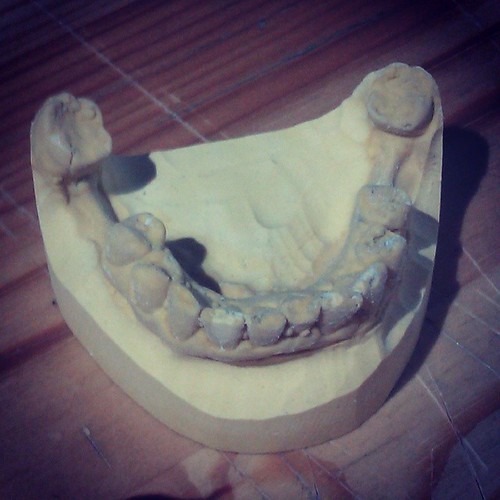 My chipped teeth mold :-P