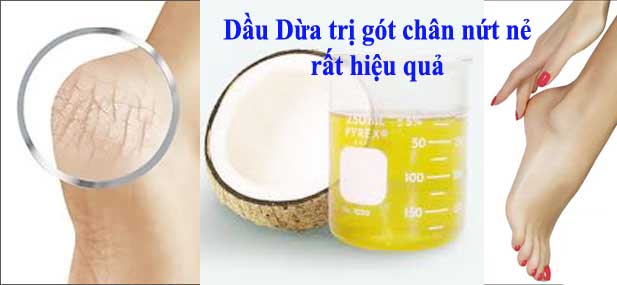 HANASHOP - Bán tinh dầu dừa nguyên chất dưỡng da,tóc,móng tay giá SIÊU RẺ NHẤT 5S - 37