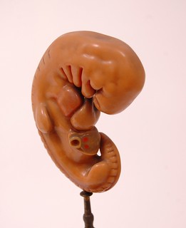 6mm Whole Embryo