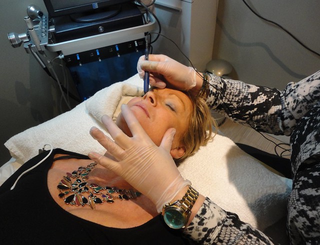 Numi laser spa in Brampton, vein removal, capillaries on nose