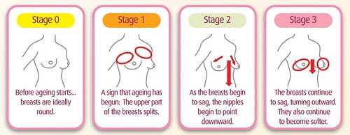 breastageing