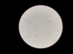 Yeast cell counting with a microscope!