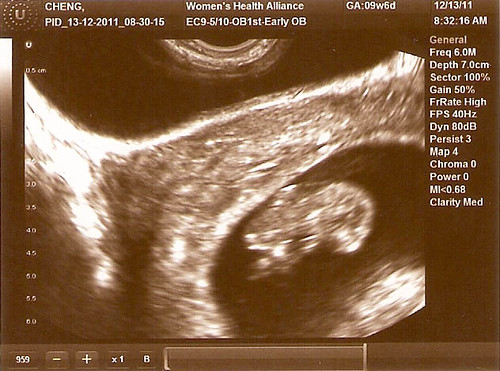 ultrasound week 9 (1).jpg