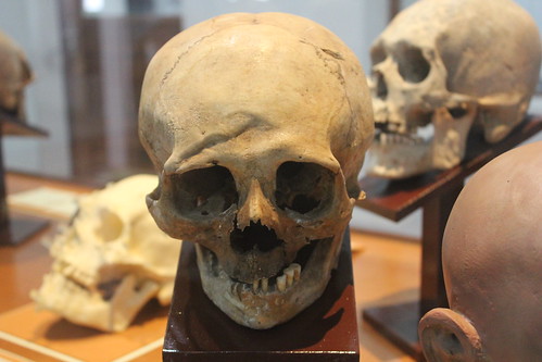 Crânes du musée Charcas