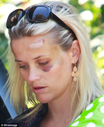 reese_witherspoon_accident