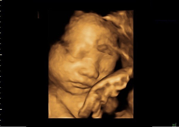 29 weeks Baby in 3D Ultrasound | Flickr - Photo Sharing!
