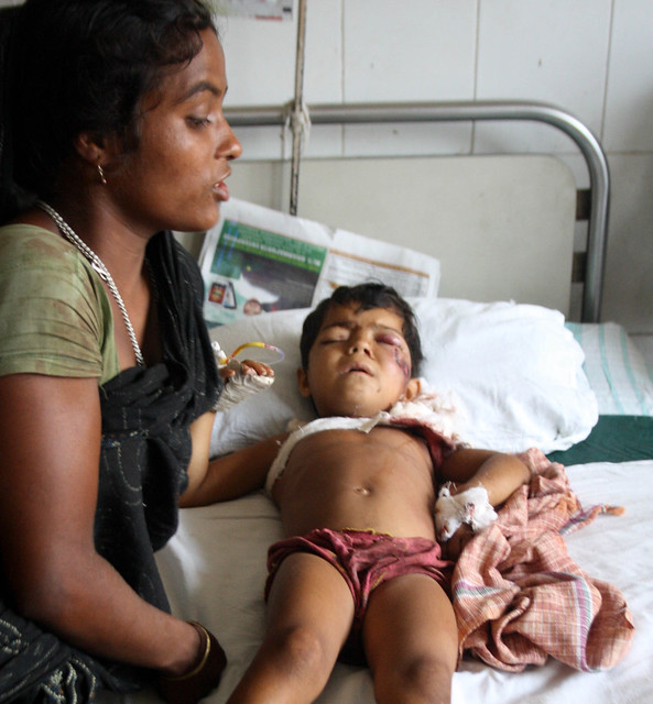Four year old Taslima Khatun is battling for her life at Guwahati Medical College Hospital