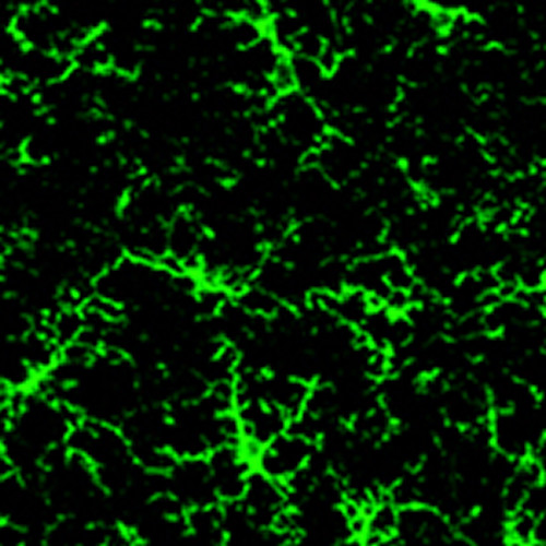This shows microglia stained green.