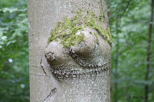 tree forest moss bosom chest cancer wald baum beech moos krebs buche busen deciduousforest laubwald brust wildwuchs geschwür