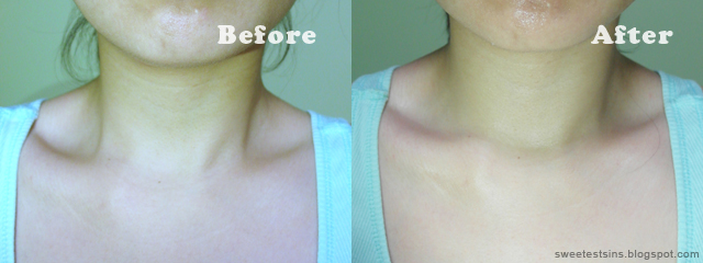 neostrata triple neck cream before and after