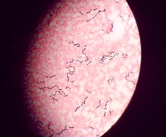 round e.i streptococcus pyogenes