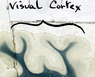 Le Gros Clark slides on the visual cortex of the rhesus monkey 