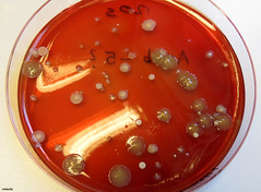Kde se zkoumají škodlivé bakterie?