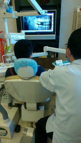 台中豐美牙醫假牙諮詢心得 假牙修磨你可以有更好的選擇 (5)