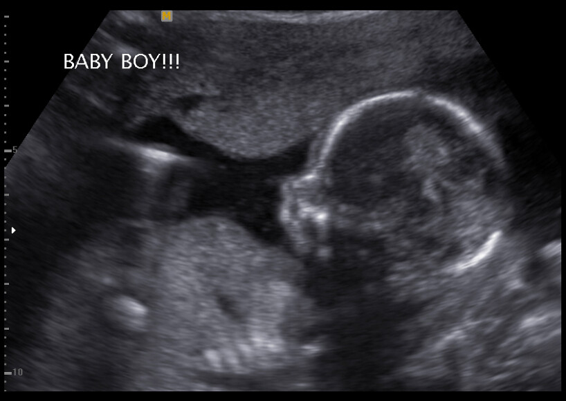 Our Baby Boy at 16 Weeks