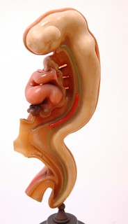 3-4mm Embryo With Opened Gut