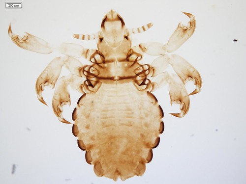 A microscopic photo of a louse collected on a host that snorts around and loves some mud on its back. 
