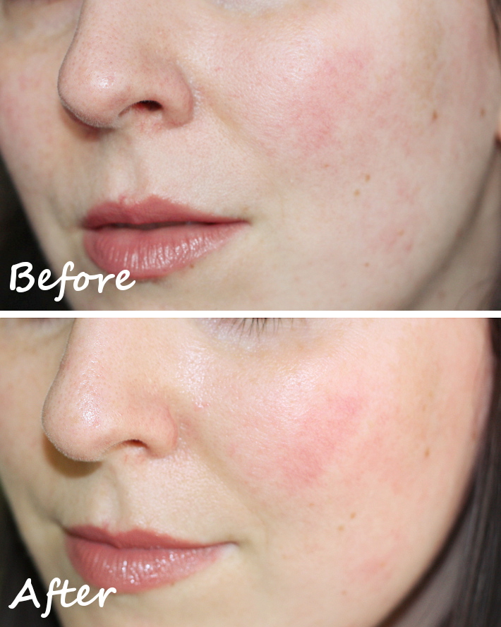  review: Darphin skincare intral redness relief for rosacea and sensitive skin 