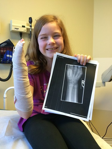 Splinted up with her X-Ray