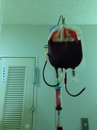 入院中に受けた輸血