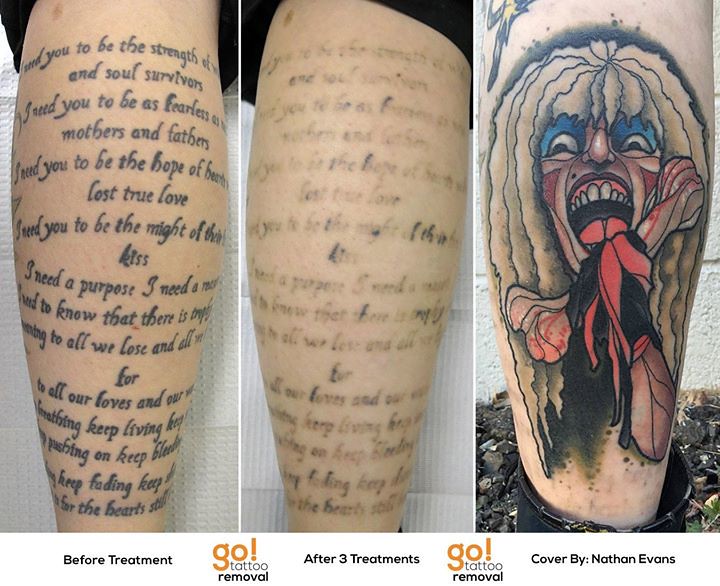 Tattoo Removal to Tattoo Cover-Up | GO! Tattoo Removal