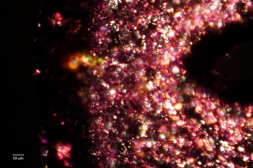 flickr lichen botany photomicrograph histology brightfield polarizedlightmicroscopy sonynex5n sony0mmf00 spencer43xobjectivena66 leicaleitzmikasmicroscopeadapter13x hematoxylingillsiiihaematoxylin spencer42petrographicmicroscopeamericanopticalao