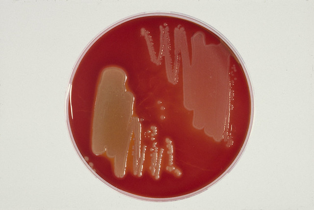 Foto 4 Groei van twee verschillende bacteriestammen op een agarplaat