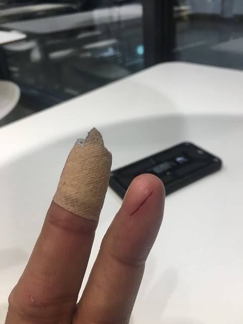 Band aid, Edmund's fingers