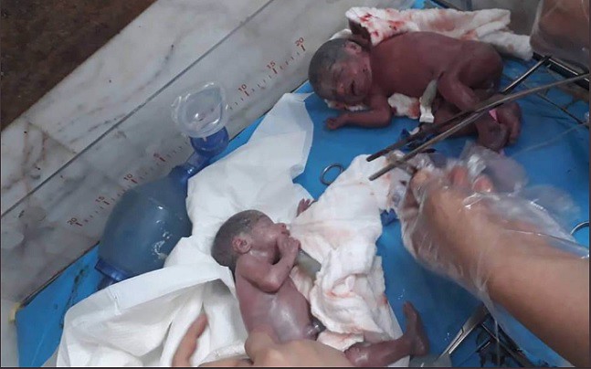 4987 An Iraqi woman gives birth to 7 kids at once 03