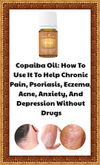 Copaiba Oil: How To Use It To Help Chronic Pain, Psoriasis, Eczema, Acne, Anxiety, And Depression Without Drugs