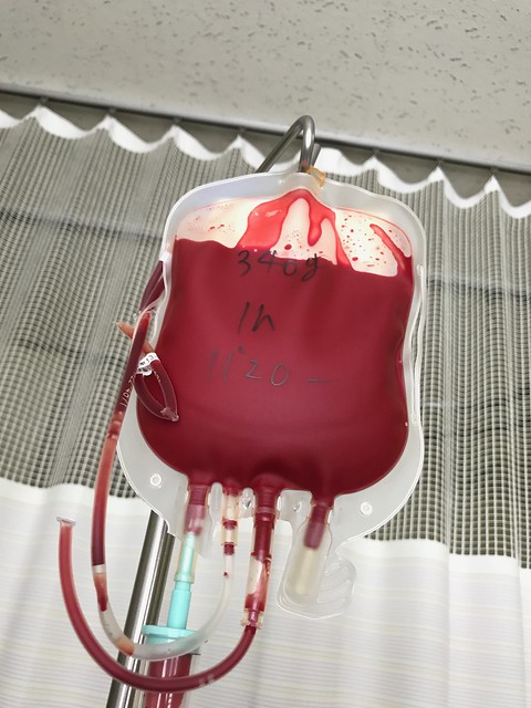 赤血球の輸血