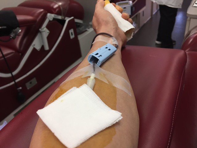 Donated whole blood