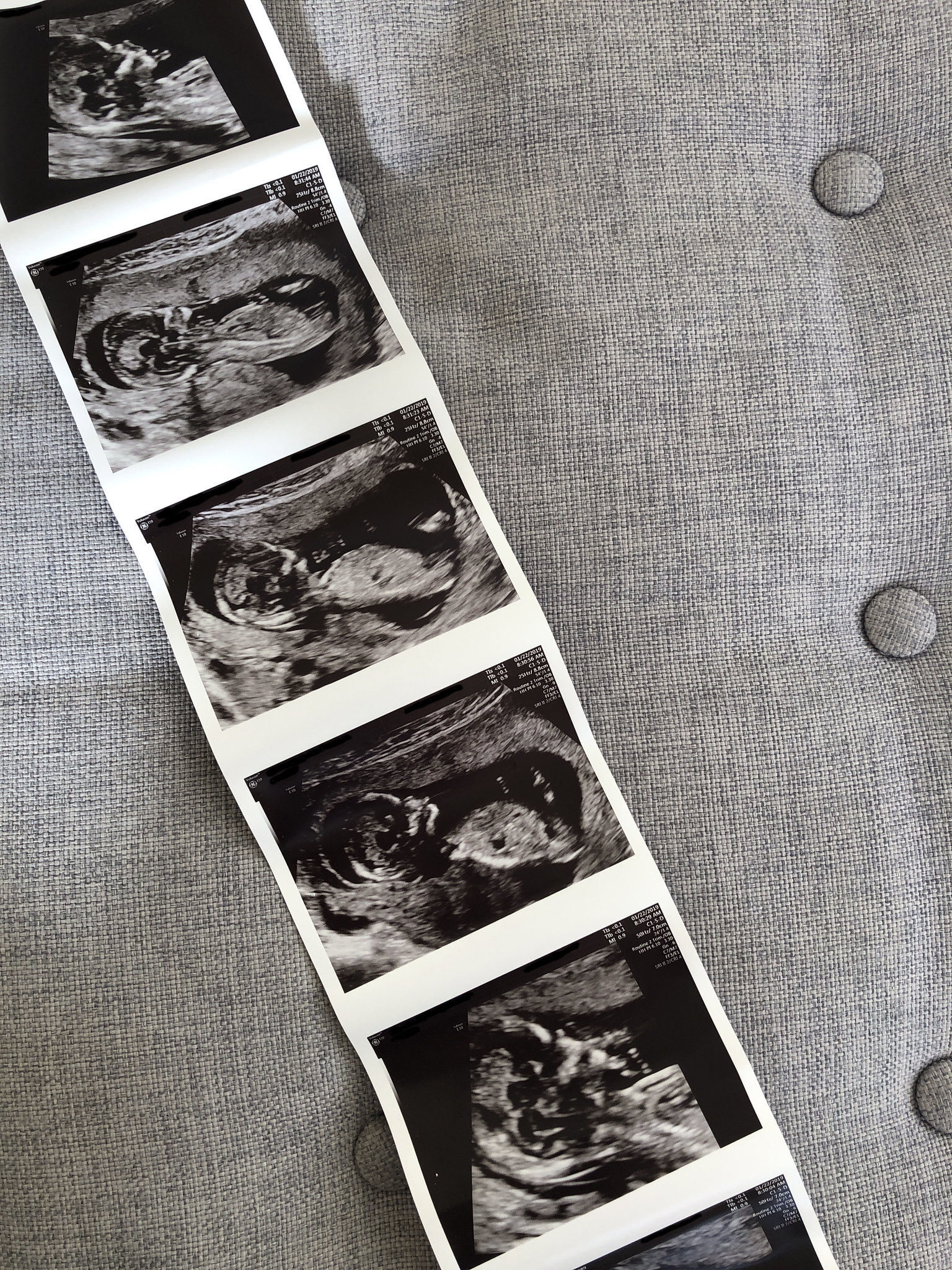 Pregnancy announcement, baby number 2, 2 under 2, pregnancy blog, scan photos, mommy blog, 14 weeks pregnant