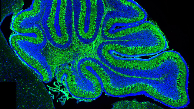 A slide of mouse cerebellum stained for Purkinje neurons in fluorescent green